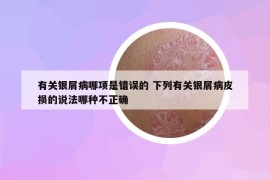 有关银屑病哪项是错误的 下列有关银屑病皮损的说法哪种不正确