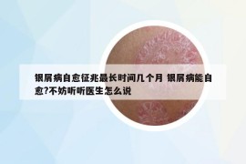 银屑病自愈征兆最长时间几个月 银屑病能自愈?不妨听听医生怎么说