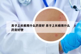 鼻子上长癣用什么药膏好 鼻子上长癣用什么药膏好使