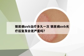 银屑病uvb治疗多久一次 银屑病uvb光疗后复发会更严重吗?