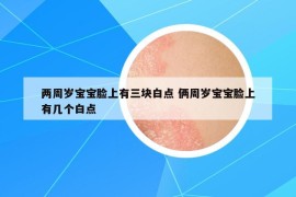 两周岁宝宝脸上有三块白点 俩周岁宝宝脸上有几个白点