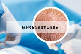 脸上没有白癜风可以化妆么