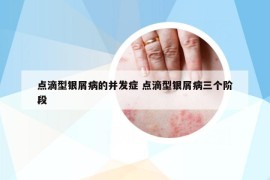 点滴型银屑病的并发症 点滴型银屑病三个阶段