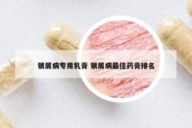 银屑病专用乳膏 银屑病最佳药膏排名