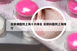 皮肤病医院上海十大排名 皮肤科医院上海排行