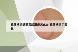 银屑病消退期又起湿疹怎么办 银屑病消了又起