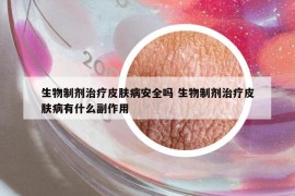 生物制剂治疗皮肤病安全吗 生物制剂治疗皮肤病有什么副作用