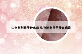 生物制剂用于什么病 生物制剂用于什么病毒