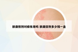 肤康擦剂对癣有用吗 肤康搽剂多少钱一盒