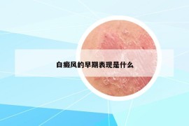 白癜风的早期表现是什么