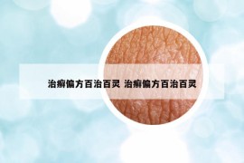 治癣偏方百治百灵 治癣偏方百治百灵