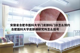 安徽省合肥市医科大学门皮肤科门诊怎么预约 合肥医科大学皮肤病研究所怎么挂号