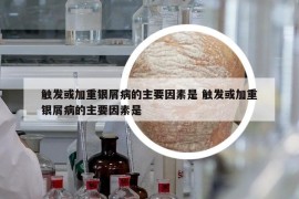 触发或加重银屑病的主要因素是 触发或加重银屑病的主要因素是