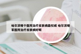 哈尔滨哪个医院治疗皮肤病最权威 哈尔滨哪家医院治疗皮肤病好呢