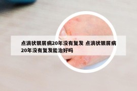 点滴状银屑病20年没有复发 点滴状银屑病20年没有复发能治好吗