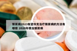 银屑病2023有望攻克治疗银屑病的方法有哪些 2020年根治银屑病