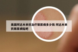 美国阿达木单抗治疗银屑病多少钱 阿达木单抗银屑病贴吧