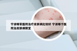 宁波哪家医院治疗皮肤病比较好 宁波哪个医院治皮肤病便宜