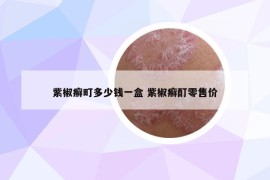 紫椒癣町多少钱一盒 紫椒癣酊零售价