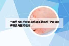 中国航天科学院银屑病康复总医院 中国银屑病研究所医院在哪