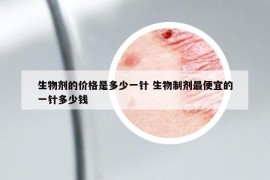 生物剂的价格是多少一针 生物制剂最便宜的一针多少钱