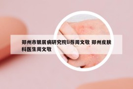 郑州市银屑病研究院li荐周文敬 郑州皮肤科医生周文敬