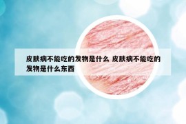 皮肤病不能吃的发物是什么 皮肤病不能吃的发物是什么东西