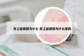 背上起癣因为什么 背上起癣因为什么原因