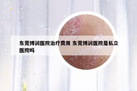 东莞博润医院治疗费用 东莞博润医院是私立医院吗