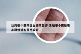 沈阳哪个医院做白癜风最好 沈阳哪个医院看心理疾病方面比较好