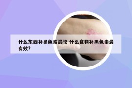 什么东西补黑色素最快 什么食物补黑色素最有效?