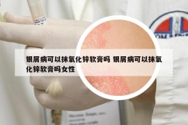 银屑病可以抹氧化锌软膏吗 银屑病可以抹氧化锌软膏吗女性