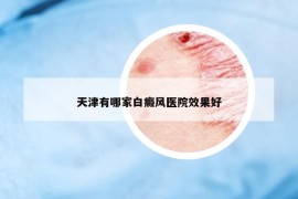 天津有哪家白癜风医院效果好