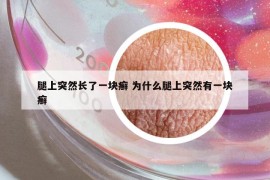 腿上突然长了一块癣 为什么腿上突然有一块癣