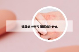 银屑病补元气 银屑病补什么