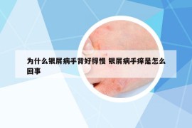 为什么银屑病手背好得慢 银屑病手痒是怎么回事