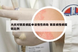 大庆对银屑病能申请慢性救助 银屑病慢病报销比例