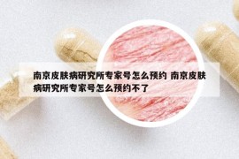 南京皮肤病研究所专家号怎么预约 南京皮肤病研究所专家号怎么预约不了