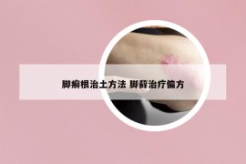 脚癣根治土方法 脚藓治疗偏方