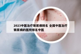 2023中医治疗银屑病排名 全国中医治疗银屑病的医院排名中医