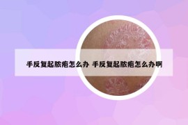 手反复起脓疱怎么办 手反复起脓疱怎么办啊