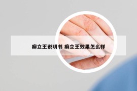 癣立王说明书 癣立王效果怎么样