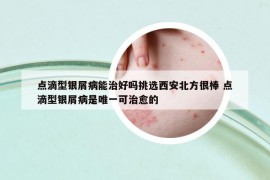 点滴型银屑病能治好吗挑选西安北方很棒 点滴型银屑病是唯一可治愈的