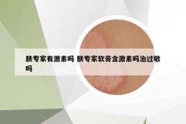 肤专家有激素吗 肤专家软膏含激素吗治过敏吗