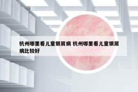 杭州哪里看儿童银屑病 杭州哪里看儿童银屑病比较好