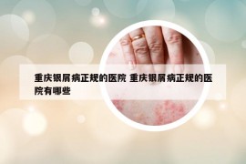 重庆银屑病正规的医院 重庆银屑病正规的医院有哪些