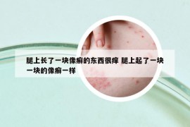 腿上长了一块像癣的东西很痒 腿上起了一块一块的像癣一样