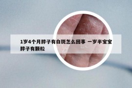 1岁4个月脖子有白斑怎么回事 一岁半宝宝脖子有颗粒