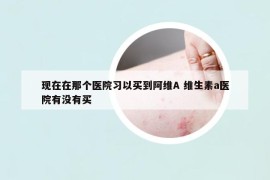 现在在那个医院习以买到阿维A 维生素a医院有没有买