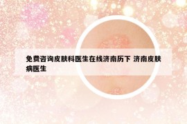 免费咨询皮肤科医生在线济南历下 济南皮肤病医生